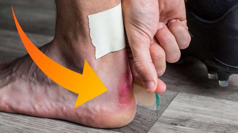 Sử dụng băng dính cá nhân để giảm đau khi mang giày thể thao